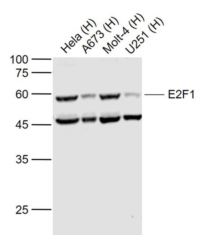 E2F1 Antibody in Western Blot (WB)