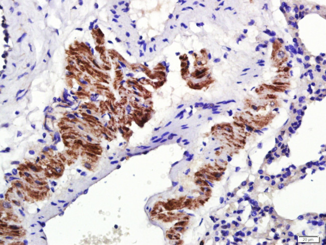 Osteopontin Antibody in Immunohistochemistry (Paraffin) (IHC (P))