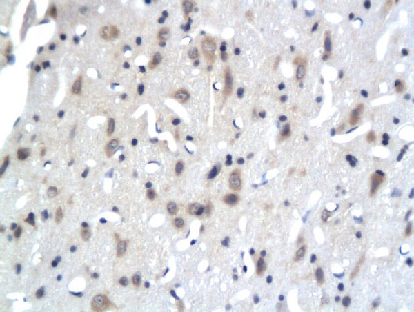 PKC epsilon Antibody in Immunohistochemistry (Paraffin) (IHC (P))