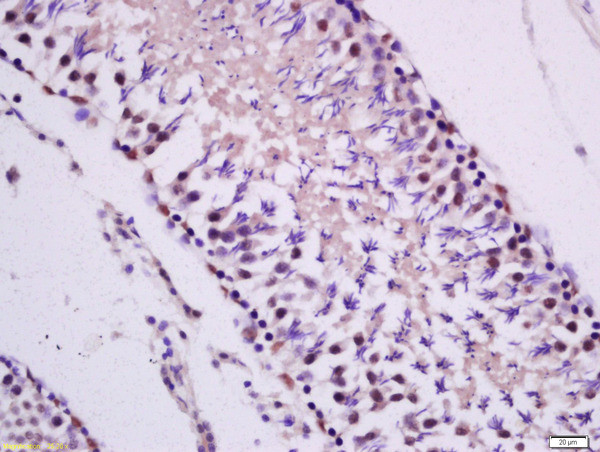 PKC epsilon Antibody in Immunohistochemistry (Paraffin) (IHC (P))