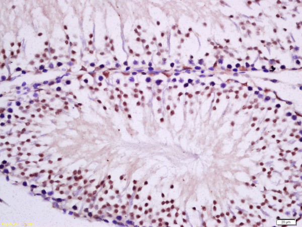 PKC epsilon Antibody in Immunohistochemistry (Paraffin) (IHC (P))