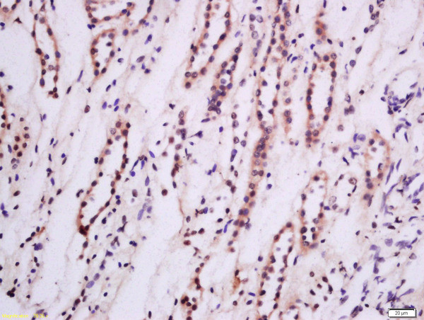 PKC epsilon Antibody in Immunohistochemistry (Paraffin) (IHC (P))