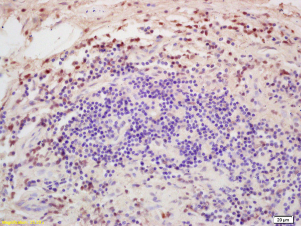 DGAT1/Diglyceride acyltransferase Antibody in Immunohistochemistry (Paraffin) (IHC (P))