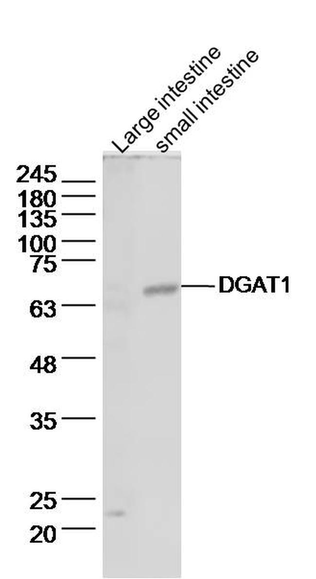 DGAT1/Diglyceride acyltransferase Antibody in Western Blot (WB)