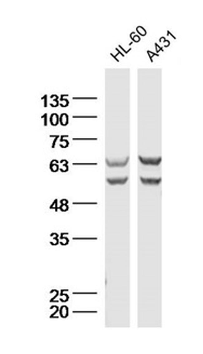 NPRC/Natriuretic Peptide Receptor C Antibody in Western Blot (WB)