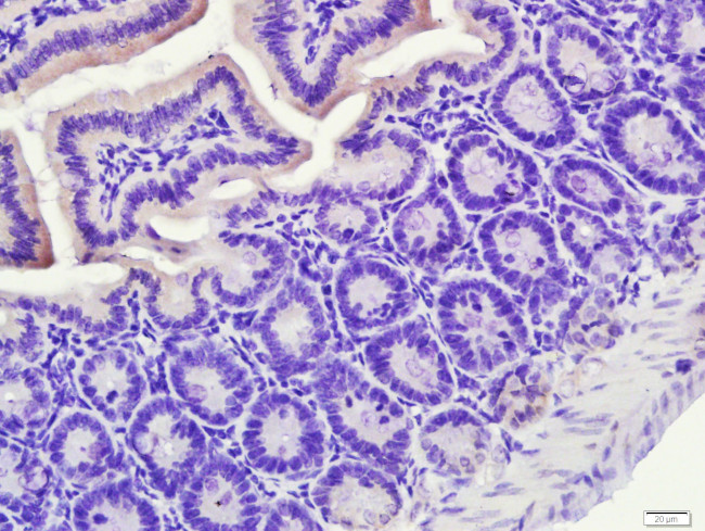 PXR Antibody in Immunohistochemistry (Paraffin) (IHC (P))