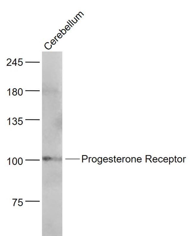 Progesterone Receptor Antibody in Western Blot (WB)