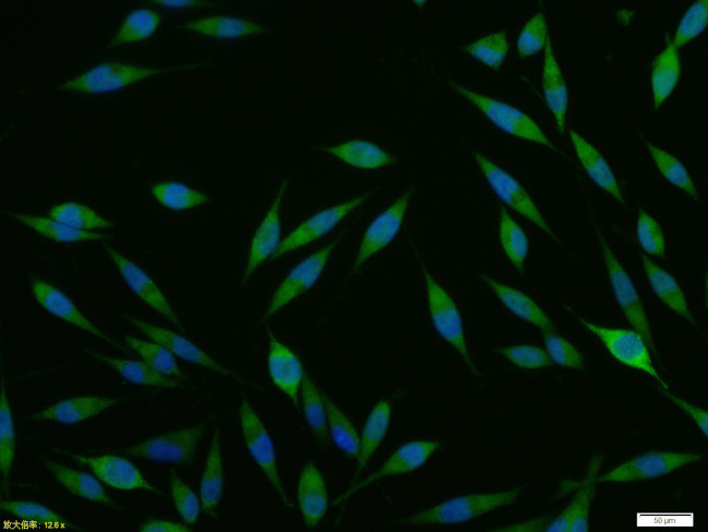 ACE2 Antibody in Immunocytochemistry (ICC/IF)