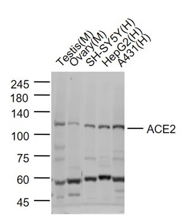 ACE2 Antibody in Western Blot (WB)