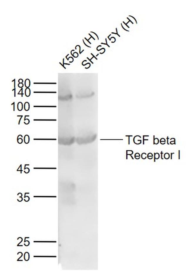 TGF beta Receptor I Antibody in Western Blot (WB)