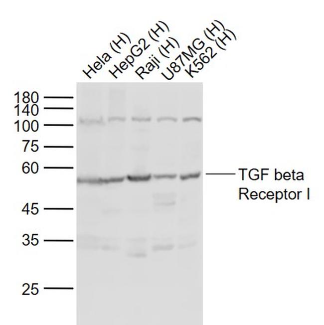 TGF beta Receptor I Antibody in Western Blot (WB)