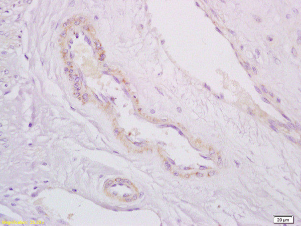 PDE5A Antibody in Immunohistochemistry (Paraffin) (IHC (P))