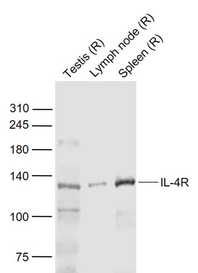 IL-4R Antibody in Western Blot (WB)