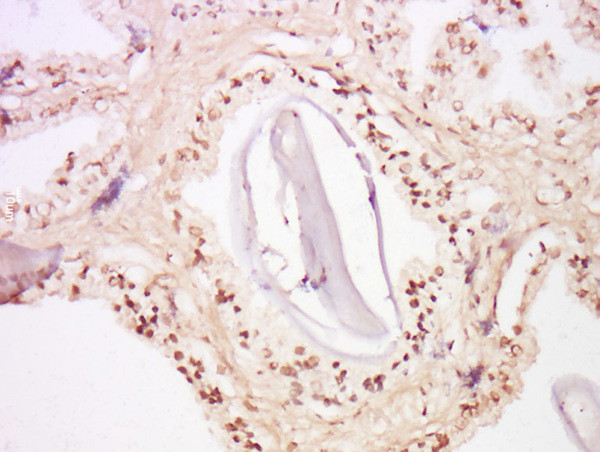 FOXA2/HNF 3beta Antibody in Immunohistochemistry (Paraffin) (IHC (P))