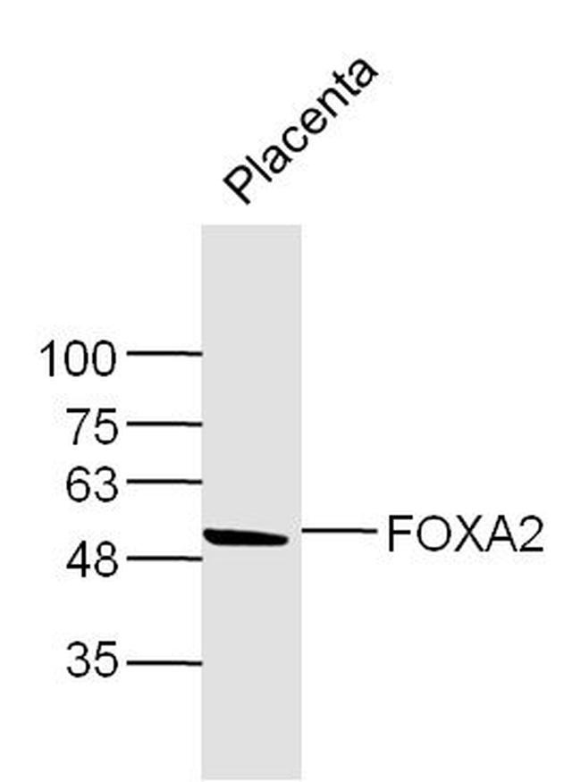 FOXA2/HNF 3beta Antibody in Western Blot (WB)