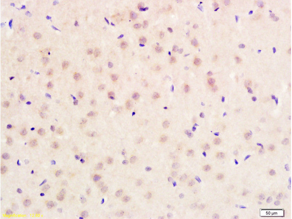 PITX3 Antibody in Immunohistochemistry (Paraffin) (IHC (P))