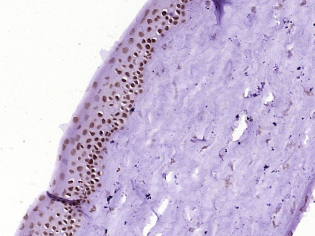 PITX3 Antibody in Immunohistochemistry (Paraffin) (IHC (P))