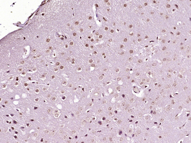 PITX3 Antibody in Immunohistochemistry (Paraffin) (IHC (P))