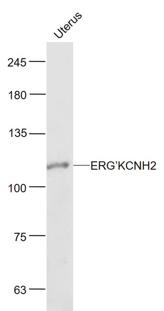 ERG/KCNH2 Antibody in Western Blot (WB)