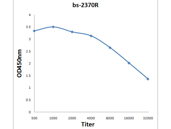 FABP5 Antibody in ELISA (ELISA)