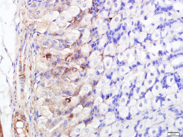 FABP5 Antibody in Immunohistochemistry (Paraffin) (IHC (P))