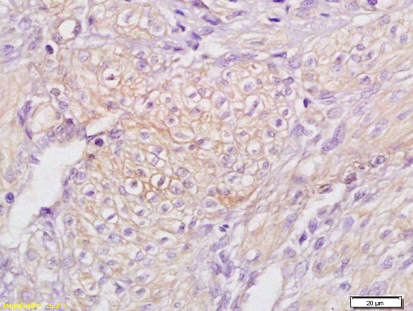 TAP2/ABCB3 Antibody in Immunohistochemistry (Paraffin) (IHC (P))