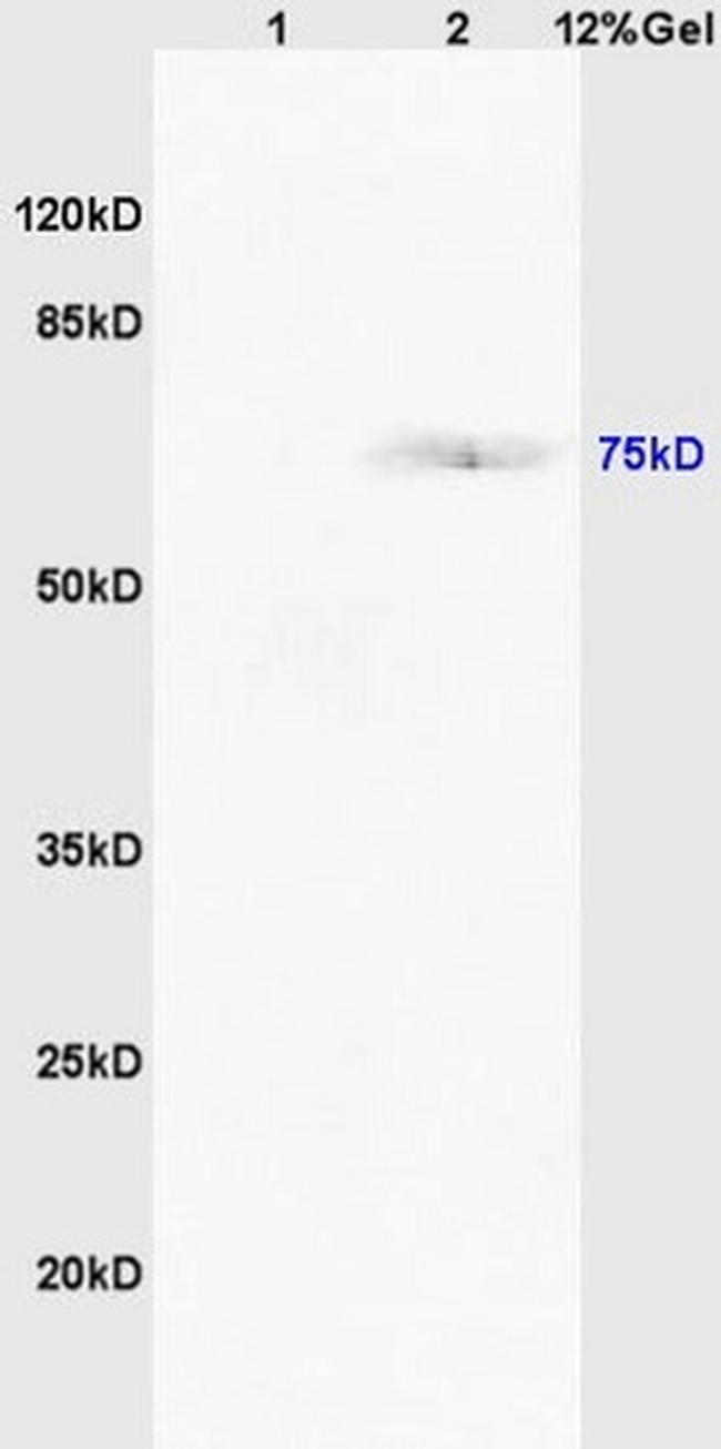 TAP2/ABCB3 Antibody in Western Blot (WB)