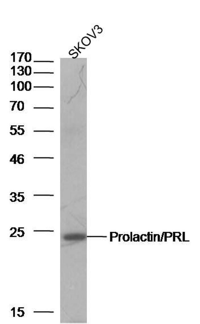 Prolactin/PRL Antibody in Western Blot (WB)