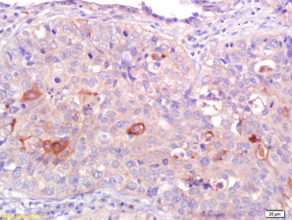 CNR2/CB2 Antibody in Immunohistochemistry (Paraffin) (IHC (P))