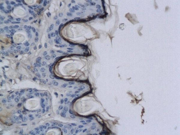 CNR2/CB2 Antibody in Immunohistochemistry (Paraffin) (IHC (P))