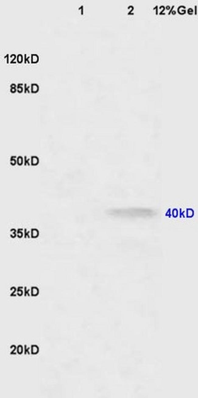 CNR2/CB2 Antibody in Western Blot (WB)