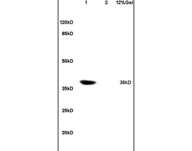 Coxsackie Adenovirus Receptor Antibody in Western Blot (WB)