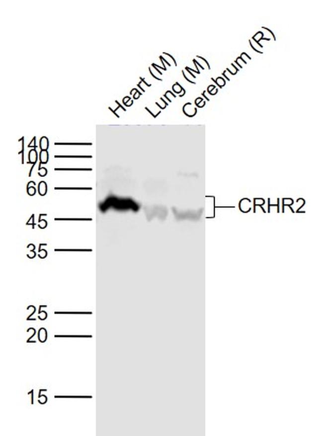 CRHR2 Antibody in Western Blot (WB)