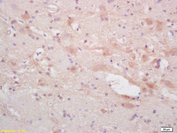 alpha Internexin Antibody in Immunohistochemistry (Paraffin) (IHC (P))