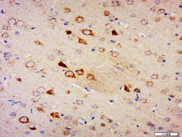 Amphiphysin Antibody in Immunohistochemistry (Paraffin) (IHC (P))