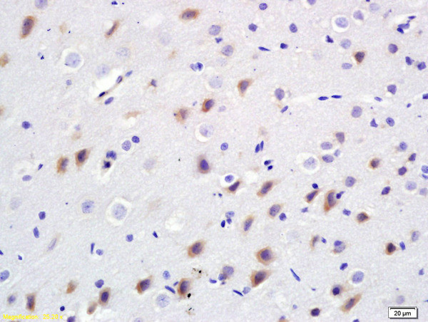 BDKRB2 Antibody in Immunohistochemistry (Paraffin) (IHC (P))