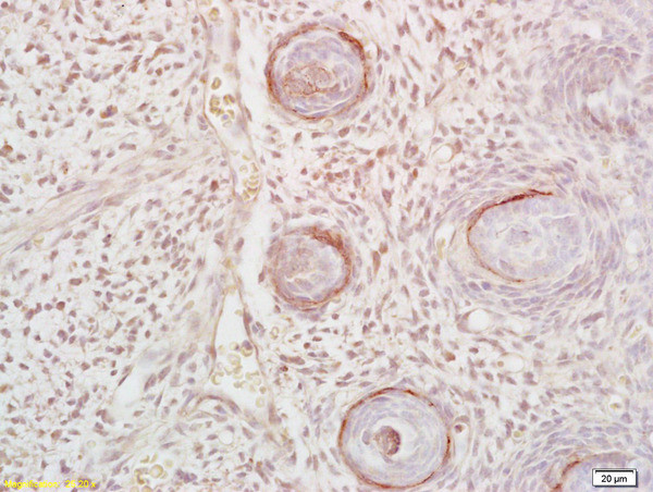 DLK1 Antibody in Immunohistochemistry (Paraffin) (IHC (P))