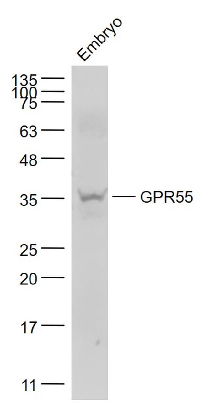 GPR55 Antibody in Western Blot (WB)