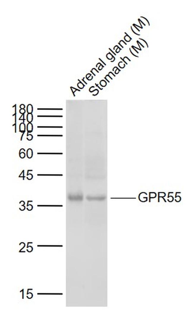 GPR55 Antibody in Western Blot (WB)