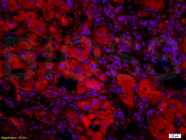 BAFF Antibody in Immunohistochemistry (Paraffin) (IHC (P))