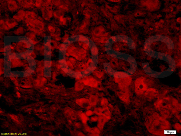 BAFF Antibody in Immunohistochemistry (Paraffin) (IHC (P))