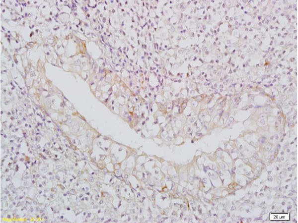 BAFF Antibody in Immunohistochemistry (Paraffin) (IHC (P))