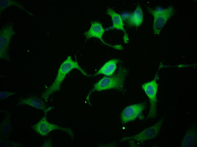 Kir6.2 (KCNJ11) Antibody in Immunocytochemistry (ICC/IF)