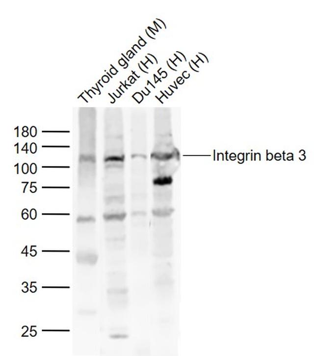 Integrin beta 3 Antibody in Western Blot (WB)