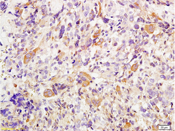 TWIST1 and TWIST2 Antibody in Immunohistochemistry (Paraffin) (IHC (P))