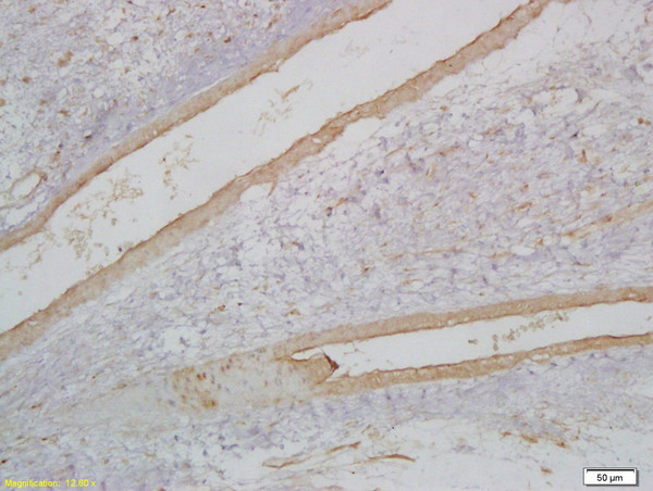 MyoD1 Antibody in Immunohistochemistry (Paraffin) (IHC (P))