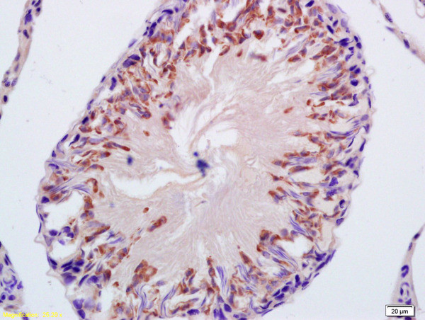 CYP21 Antibody in Immunohistochemistry (Paraffin) (IHC (P))