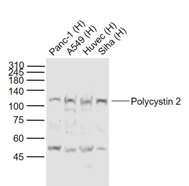 Polycystin 2 Antibody in Western Blot (WB)