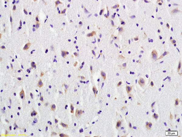 CD137 Antibody in Immunohistochemistry (Paraffin) (IHC (P))