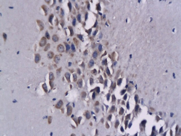 CCL17 Antibody in Immunohistochemistry (Paraffin) (IHC (P))